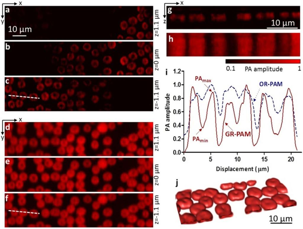 Wang et al. Page 11 Fig. 3. (a c) Optically sectioned GR-PAM images of red blood cells at three depths. (d f) Optically sectioned OR-PAM images of the same sample as in (a c).