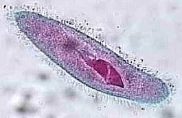 Cilia Not in Prokaryotes Only Animals and Some Protists Short,