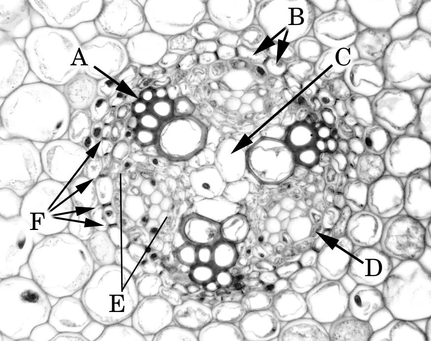 Place the slide of an immature root of Ranunculus on your microscope and survey the section at 40x. This cross section was made closer to the apical meristem of the root, and has immature tissues.