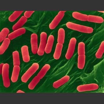 diseases Cell: Escherichia coli (E.