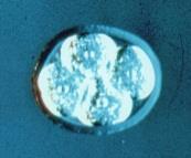 from embryos from unused IVF treatments.