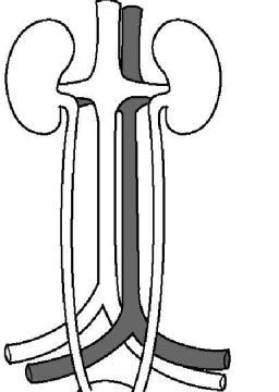 SULIT 4 2. Diagram 2 shows excretory organs in our body.
