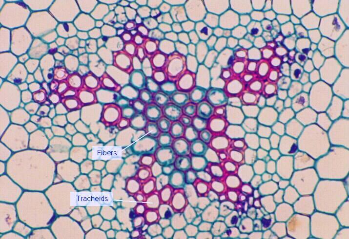 tell that these central cells are not tracheids. Also figure out which xylem tracheids are protoxylem and metaxylem (the longitudinal section should help).