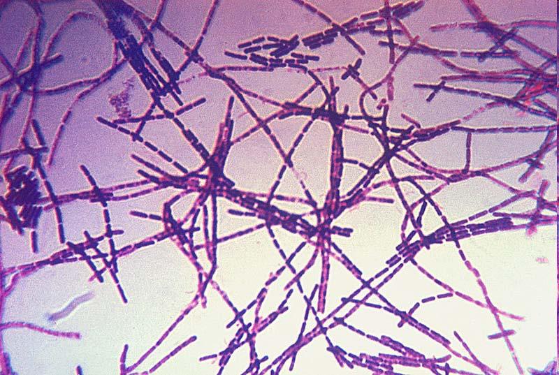 Bacillus anthracis Causes