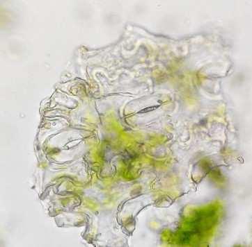 Mesophyll cell Epidermal cell Calcium