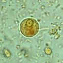 Compatible myxamoebae fuse. Spore (n) Zygote (2n) Plasmodium Haploid spores are released. Sporangium Coenocytic plasmodium (2n) Sporangia grow from plasmodial masses.