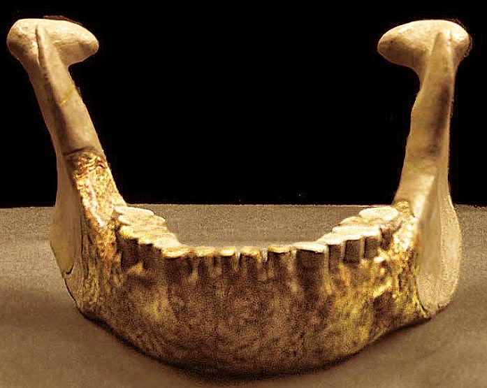 The skull was low and flat with thick walls and a small brain volume of 780 ml, indicating its resemblance to the small-brained Java man.
