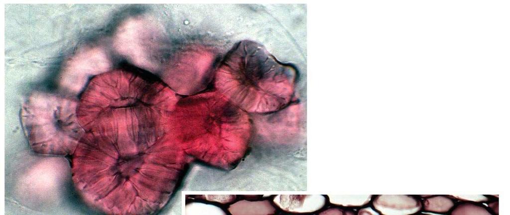 Fig. 35-10c 5 µm Sclereid
