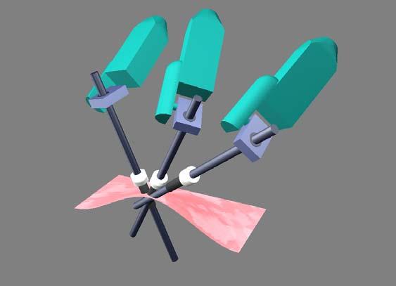 Laparosopi surgery Control of the position of the spot 2D diret isual seroing sheme (Image-based) z s p ω + - Z ˆ B { B} k s p 1 J ω ω z J op ( q, d1) 1 q Robot