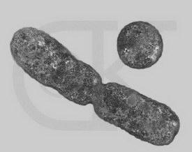 (example- Clostridium botulinum produces toxins that can cause an extreme form of food poisoning called botulism.