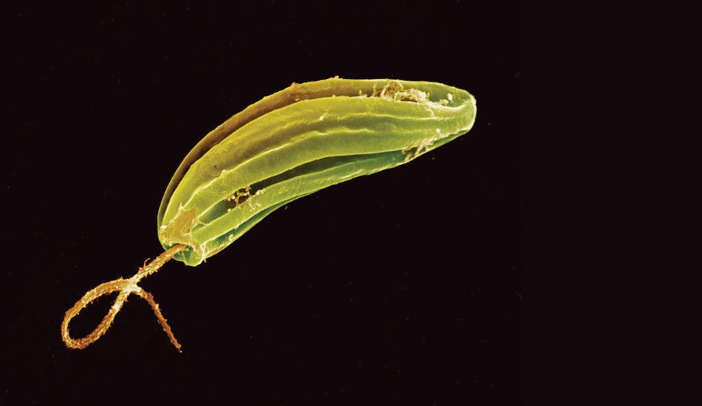 19.2 Animal-like Protists Protozoa with flagella are