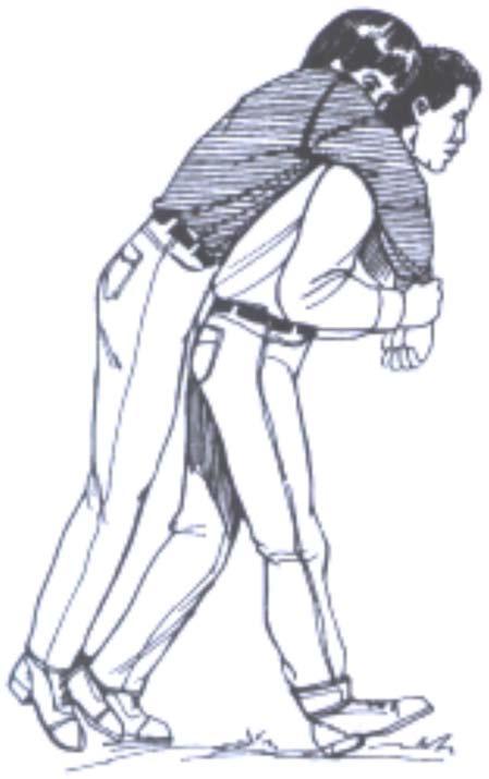 Packstrap Carry This is a quick, easy carry for very short distances. The casualty must be able to stand to get into position with their arms across the shoulders like packstraps.