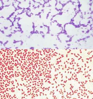 EUBACTERIA are either Gram positive, stain purple with thicker cell walls more