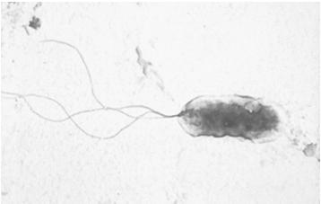 Arrangement of flagella whip-like threads types used to propel cell Polar (lophotrichous) Pseudomonas Peritrichous Erwinia Generally, an electron microscope is needed to see