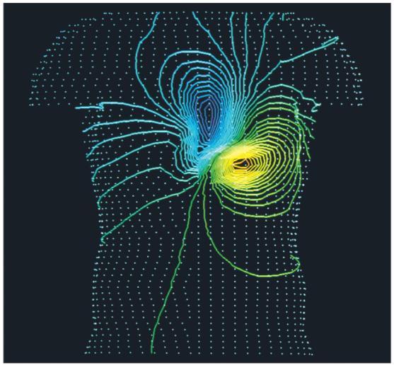 The Electric Potential of a Human Heart The Electric Potential of a Human Heart Electrical activity within the body can be monitored by measuring equipotential lines on the skin.