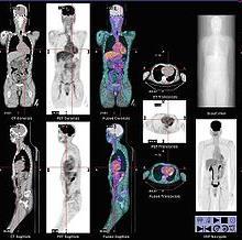 physiological function of different organs Gamma camera Imaging using radioactive materials: Positron emission tomography