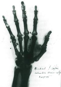 X-rays Wilhelm K.