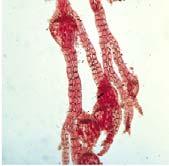 Rhodophyta are red algae unlike other eukaryotic algae, they lack flagella at any