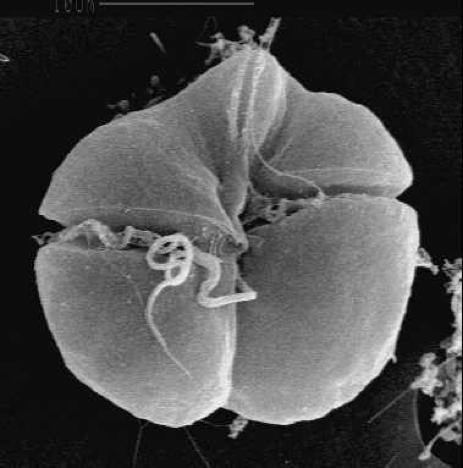 Karenia brevis Karenia brevis (SEM) One species of dinoflagellate that causes red tides Produces a toxin that kills fish and invertebrates
