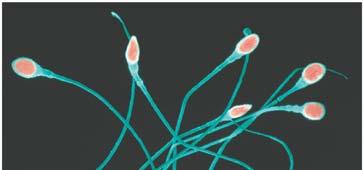 Spermatogenesis In the male testes, sperm are produced. One cell produces 4 sperm.