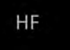 HF + H 2 O(l) H 3 O + (aq) + F - Acid