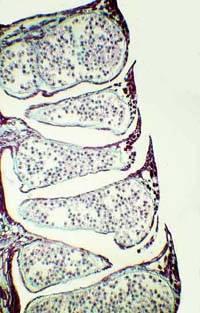 The male (staminate) cone consists of protective scales called (microsporophylls) that contain microsporangia