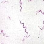 6) Examples: Streptococcus pneumonia, Staphlococcus aureas, Bacillus cereus B.