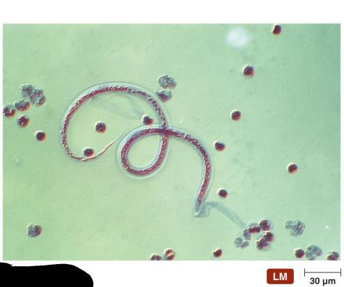 Figure 1.8 An immature stage of a parasitic worm in blood. Why Parasites? Red blood cell Immature stages are microscopic youtube-history-micro https://www.you tube.com/watch?