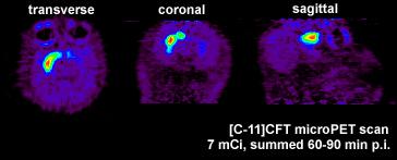 [C-11]β-CFT micropet Imaging of Simian Unilateral MPTP