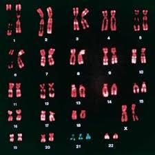 Chromosome Abnormalities: These may happen on account to the fact that in meiosis if it does not occur properly it could lead to a baby having one more or one less chromosome (extra = trisomy;