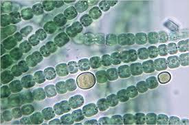 Nostoc Oscillatoria 16. What are the basic cyanobacterial cell shapes?