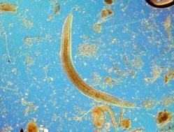 Phylum Nematoda Roundworms Whip-like body motion Molt cuticle to grow (not an