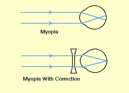 Mirrors that curve inward so that the observer is looking into the "scoop" of the mirror are called concave (or converging) mirrors.