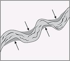 2003, Question 24: Multiple-Choice Standard: Earth's History - 6 The diagram below shows a river. The shaded land areas on either side of the river were most likely formed by A. tectonic activity. B.