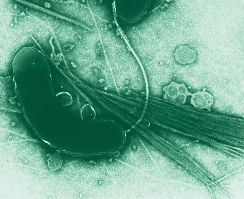O395 Cholera wild type. Transmission electron microscope (TEM) image of Vibrio cholerae that has been negatively stained.