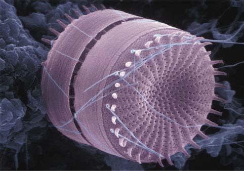 Algae: Diatoms Unicellular algae with a