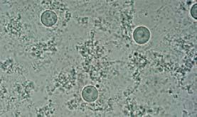 amoebae form microcysts and become dormant.