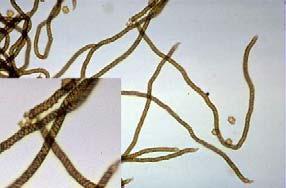 Variations in Myxomycete Structures Trichia favoginea elaters