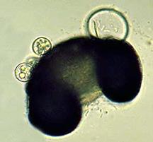 Chytridiomycota Zoospores Division: Chytridiomycota Morphologically, the Chytridiomycota does not appear related to the true fungi.