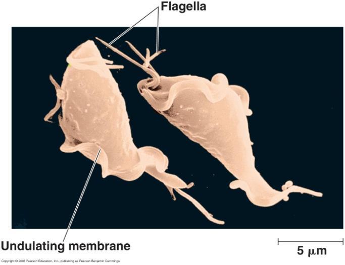Parabasala Large modified golgi parabasal body No/reduced mitochondria