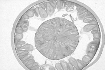 Ascaris (roundworm) Cross Section mesoderm