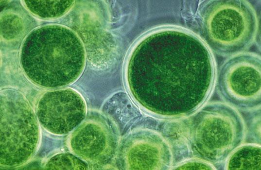 KINGDOM PROTISTA : Volvox- Green Algae (Plant-like) Eukaryotic
