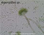 2. Ascomycetes : (Sac fungi) Multicellular (penicillium ) / Unicellular ( yeast ) Saprophytic decomposers parasitic coprophilous Mycelium is branched and septate asexual spores are called conidia