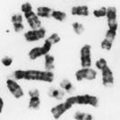 Are DNA composed of a nitrogen base, a phosphate group, and a sugar. Found on Chromosomes pictured left.