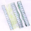 elastic - Secondary cell wall: forms around primary cell wall after growth is complete Supports (grow