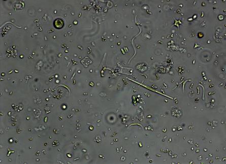 LSU Main Lake Phytoplankton Observations Based on our microscopic observations of