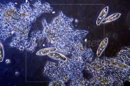 Diatoms & Dinoflagellates