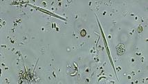 Paramecium & Amoeba Plants