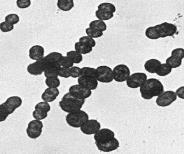 Archaebacteria Cell type: prokaryotic Methanogenium frigidum Kingdom: Eubacteria Cell type : prokaryotic
