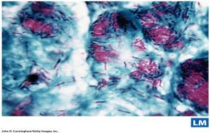 Ziehl-Neelsen Acid Fast Stain Acid Fast Bacteria Identifies Mycobacterium (tuberculosis & leprosy) Stain red because of the lipids in their cell membranes Flagellar staining Detects motility Metal